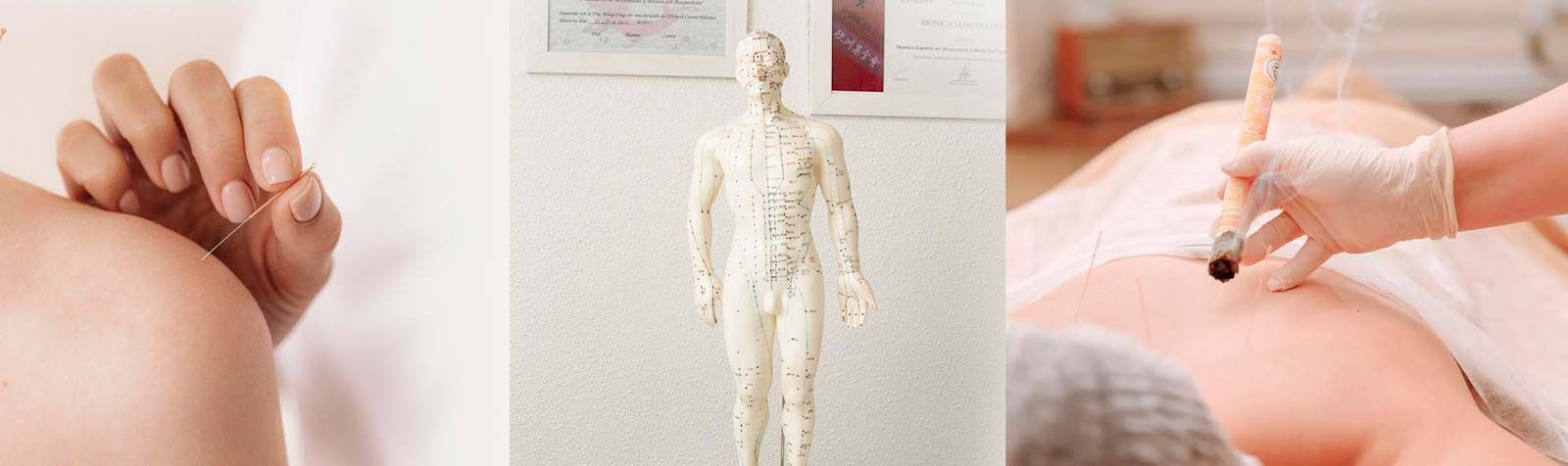 Medicina tradicional chin